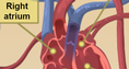 Screenshot of Circulatory System Gizmo